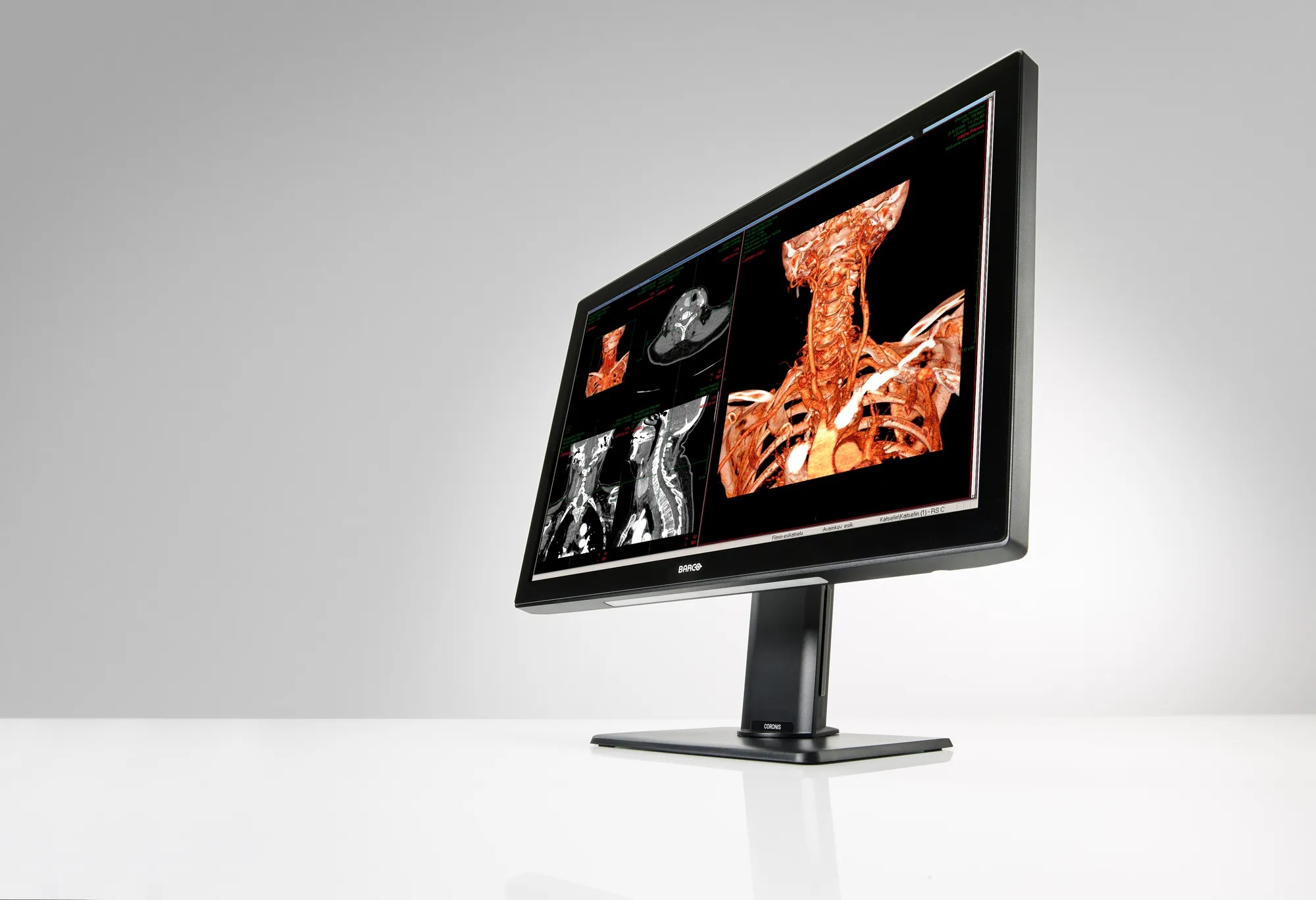 Barco Coronis Fusion MDCC-6530 Medical Diagnostic Monitor
