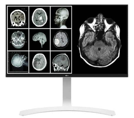 alternative Monitors for Radiology