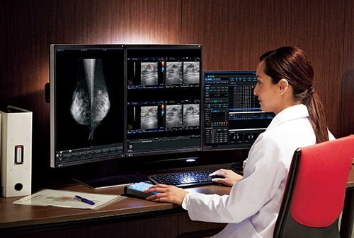 monitors for radiology or OLED TVs